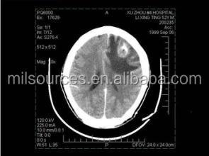 China Kodak X-Ray Film Carestream DVB Original in USA 35X43 Medical Dry Film Medical X-Ray Laser Printer at One Sale DVB for sale