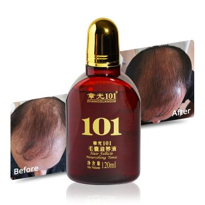 China Daily Hair Loss Hair Growth Treatment Products Professional Natural Serum for sale