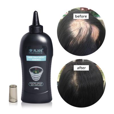 China Natural Herbal Organic Hair Loss Prevention Private Label Oil Hair Loss Treatment for sale