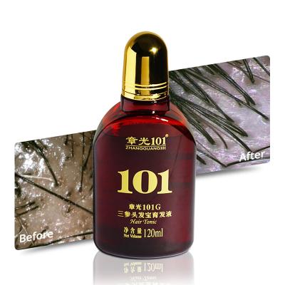 China Daily Natural Organic Plant Extract Hair Fall Oil Control Growth Hair for sale