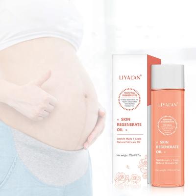 China Regenerated Stretch Marks Removal Oil OEM Vegan Body Oil Repair Skin Revitalizer Skin Massager Oil Organic for sale