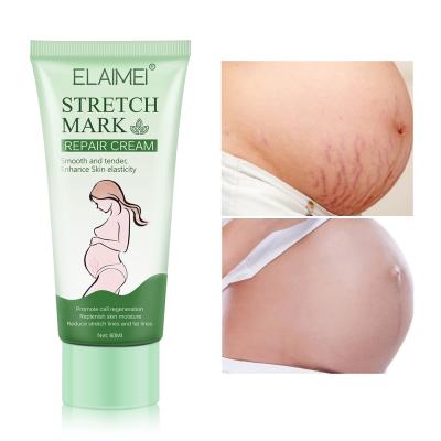 China Skin Revitalizer 100% Organic Vegan Postpartum Stretch Mark and Scar Removal Repair Stretch Mark Cream for sale