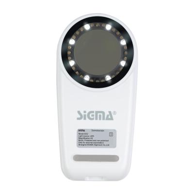 China Pigmentation Analysis SIGMA SD2 Handheld Medical Magnifier For Skin Analyzer LED Pocket Dermatoscope for sale