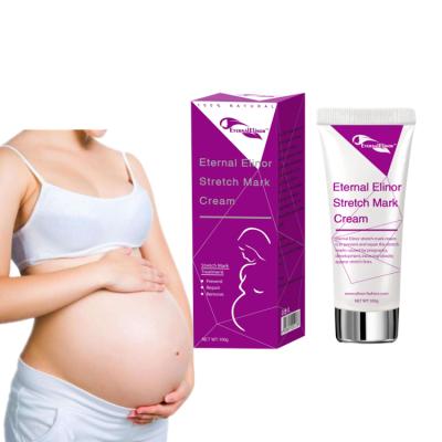 China Good Quality Exfoliator Private Label Scar Stretch Marks Treatment Body Care Pregnancy Women Stretch Mark Cream for sale