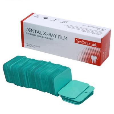 China Dental X Ray Radiation X Ray Diagnosis Darkroom Used Dental X-Ray E Gear Film For Dental X-Ray Film GY-E for sale