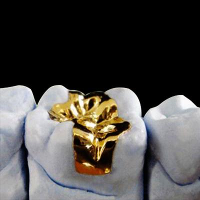 China Dental Crowns Crown And Bridge ARGENCO 52HN High Noble Crown for sale