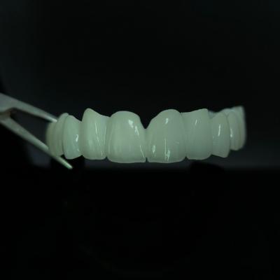 China High Translucent Crown And Bridge Zirconia Bridge Layered China Dental Lab Work for sale