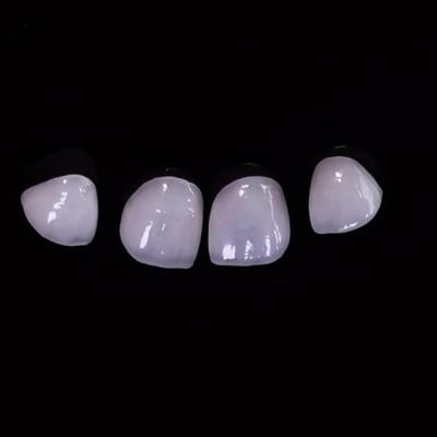 China Hochdurchlässige Zahnlaminaten Veneers Emax Laminat Veneers 0,3 mm bis 0,5 mm zu verkaufen