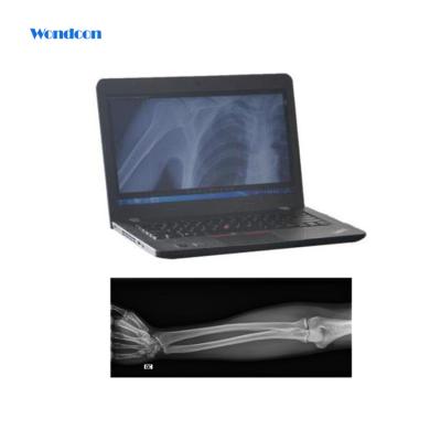 China Digital X Ray Imaging Medical Portable X Ray Machine Prices Medical Imaging Devices for sale