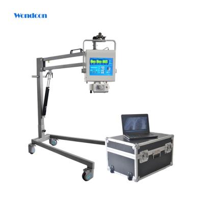 China Medical Mobile Hospital Equipment Digital X-Ray Machine Price WME910D for sale