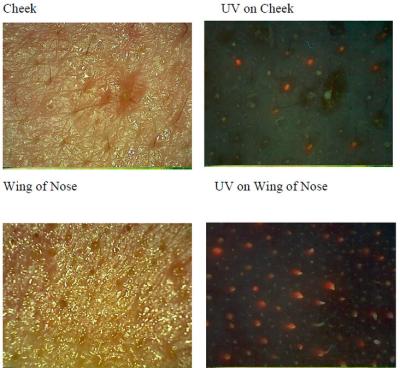 China Máquina uv facial do analisador da pele para a pele Mositure/graxa/enrugamento/pigmentação à venda