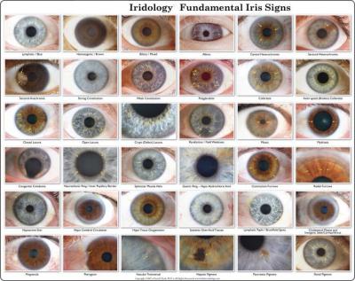 Cina Pixel mega dell'analizzatore di Iriscope dell'occhio di USB/dell'analizzatore 12,00 macchina fotografica di Iridology in vendita