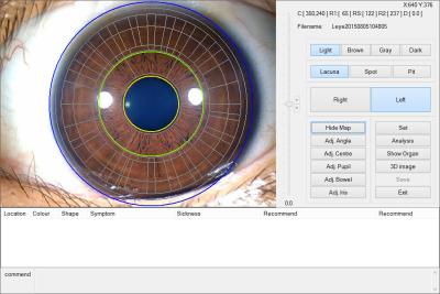 Cina approvazione della macchina di prova dell'occhio della macchina fotografica di 12.0MP Digital Iriscope Iridology CE/DHL in vendita