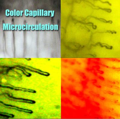 中国 医学のための病院の爪郭の毛管顕微鏡検査/Microcirculation の顕微鏡の多機能 販売のため