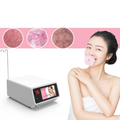 China Blood Vessels Removal 980nm Diode Laser Removal 30w Spider Vein Vascular Removal for sale