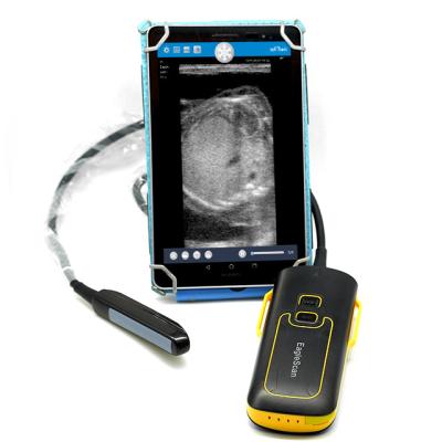 China Direct Scanner Wifi Wireless Ultrasound Portable Manufacturer Ultrasonido Bovino for sale