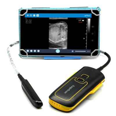 China Wholesale Price Ultrasom Skaner Sonov6 Ruminants Wireless Ultrasound Radio for sale