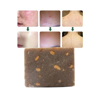 China OEM ODM Private Label Clean Natural Pure Natural Handmade Whitening Exfoliating Whitening African Black Soap for sale