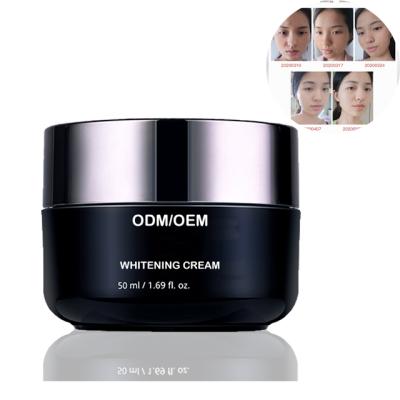 China best whitening nourishing kojic acid whitening face cream for sale