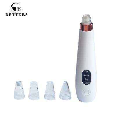 China Acne Treatment IMPROVE 2021 Pore Vacuum Blackhead Remover Acne Removal Vacuum for sale