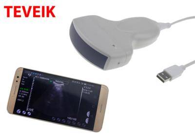 China color Wireless Wifi Ultrasound Machine  Protable wireless ultrasound probe Convex for sale