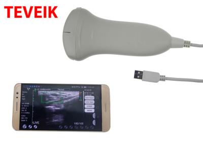 China CE USB Ultrasound Machine Laptop Tablet Ultrasound Scanner Convex  Probe for sale