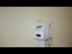 America Import Diode Laser Hair Removal Equipment for Safe and Painless Treatment