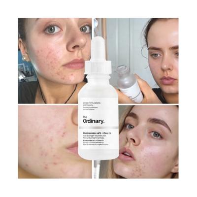 China Skin Revitalizer Whitening Brighten Skin Tone Regulate Sebum Shrink Pores Reduce Acne Marks Niacinamide 10% + Zinc 1% Ordinary Serums Facial Oil for sale