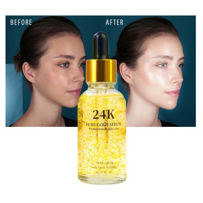 China Skin Revitalizer Dark Spot Remover Anti Wrinkle Anti Aging Nourishing Whitening Brightening 24 K Gold Collagen Gluta Kojic Facial Serum for sale