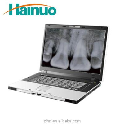 China F-100 Digital High Sensitive Intraoral Dental X-Ray Sensor 20'; ¼ m for sale