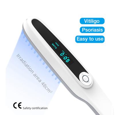 Chine Clinic home use mini psoriasis equipment 311nm medical device uvb treatment uv phototherapy lamp for vitiligo à vendre