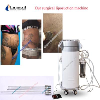 China Weight Loss Women Body Slimming Machine Slimming Products Surgery Weight Loss Slimming Equipment for sale