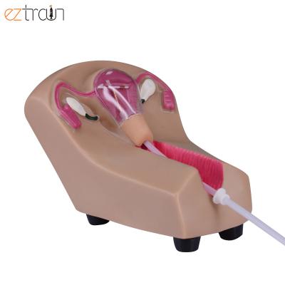 China IUD Demonstration IUD Training Simulator Ovary Uterus Anatomy Model for Intrauterine Contraceptive Device Training for sale