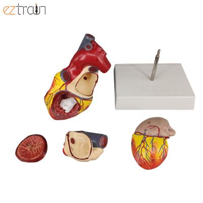 China 4 parts detachable human heart anatomy model, 2 times life size, 4 parts with number remark for sale