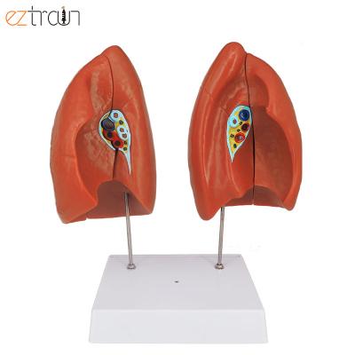 China 1 pc budget lungs models (4 parts), Lung Anatomy Model for sale