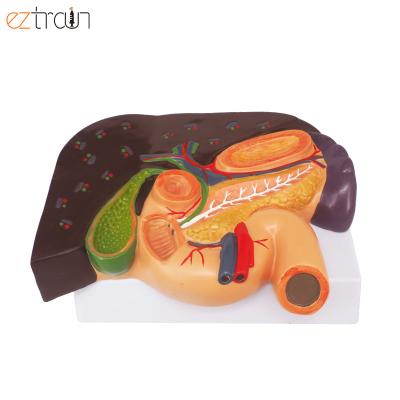 China 1 Liver and Gall Bladder Relief Model of PC, Pancreas and Duodenum for sale