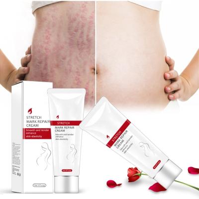 China Skin Revitalizer Private Label 100% Natural Vegan Postpartum Deep Scar Removal Anti Acne Stretch Mark Cream for sale