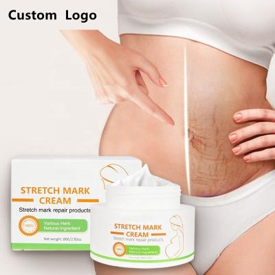 China Skin Revitalizer Private Label 100% Natural Vegan Postpartum Deep Scar Removal Anti Acne Stretch Mark Cream for sale