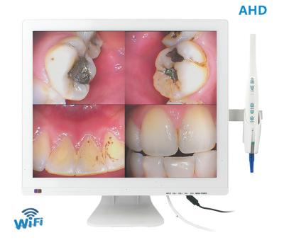 China De draadloze Tand Digitale Mouthwatch Intraoral Camera van Wifi 17 Duim HOOFDmonitor Te koop