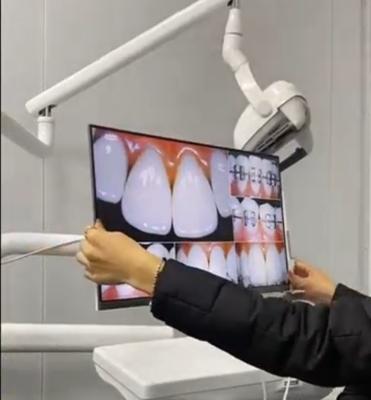 China O monitor dental 21,5 do computador de secretária da montagem da parede avança a câmera oral intra do monitor branco da visualização ótica do diodo emissor de luz do LCD à venda