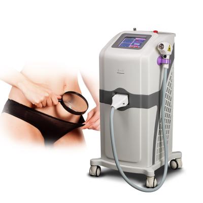 China Skin Tightening Miracle Epilator Speed ​​Permanent 808nm Diode Laser For Hair Removal for sale