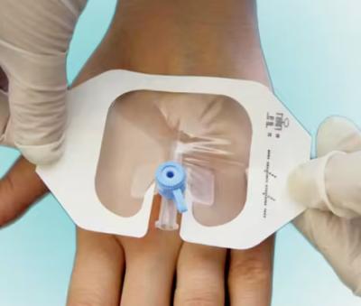 China Adhesivo estéril IV Cánula Fijador de vendaje Transparente Bandaje médico para heridas en venta