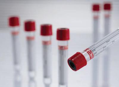 China Red Cap Plasma Separation Tube Vacuum Blood Collection Tube No Additive Tube for sale