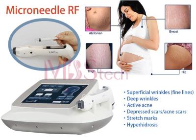 China Máquina de la elevación de cara del retiro de las marcas de estiramiento Rf Microneedle en venta