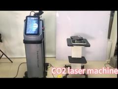 vertical  CO2 laser machine