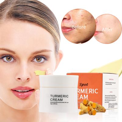 China Dark Circles Private Label Turmeric Acne Treatment Natural Brown Spot Removing Facial Skin Whitening Turmeric Turmeric Cream Face Cream for sale