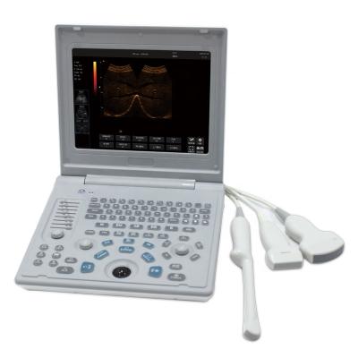 China Urology Sonostar SS-6B Ultrasound Machine, Better Than SS-7 for sale