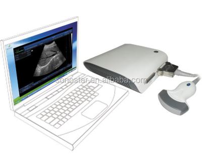 China 2020 Professional Portable Ultrasound Diagnostic System UBox-10 for sale