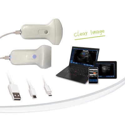 China Acrylic Portable Ultrasound Wifi Handheld Wireless Probe for sale