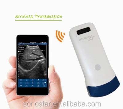 China UProbe-C5C Sonostar Portable Convex Abdomen Ultrasound Machine for Pregnancy Scanner for sale